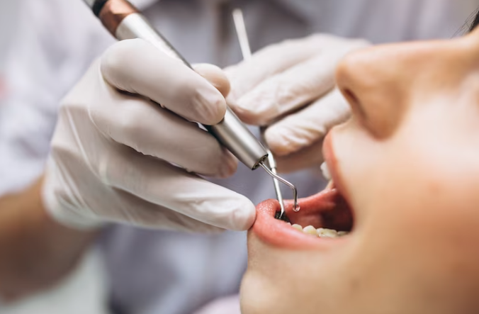 endodoncia